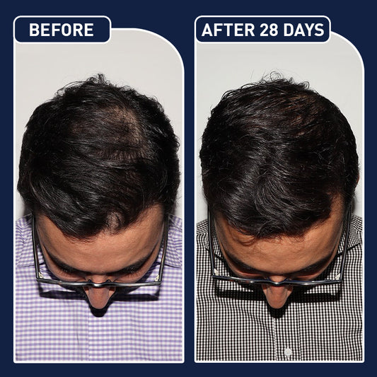 بخاخ الشعر FEG Plus