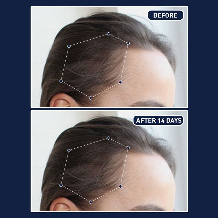 بخاخ الشعر FEG Plus