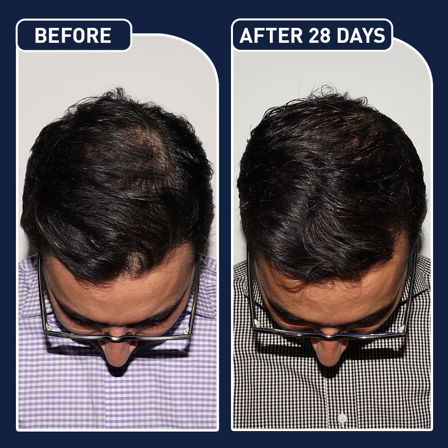 بخاخ الشعر FEG Plus