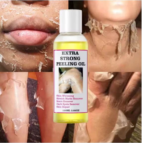زيت التقشير (110 مل)