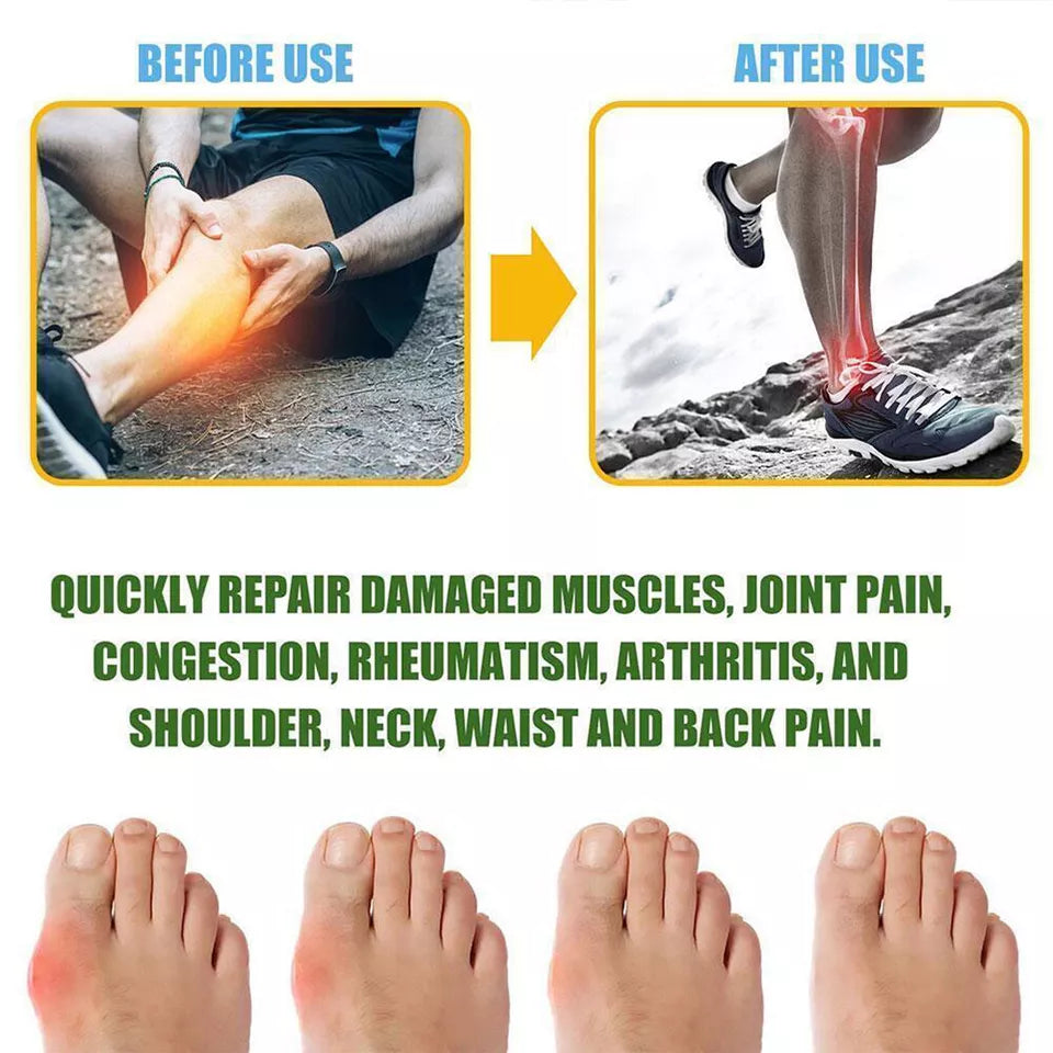 بخاخ لتخفيف الألم للرياضيين